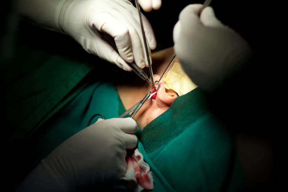 A cosmetic surgery patient's ear undergoes operation in Shenzhen, China
