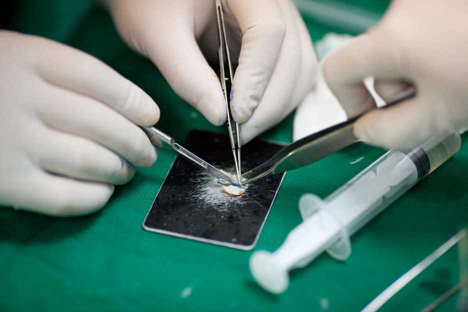 Cutting a piece of cartilage during a nose-enhancement cosmetic surgery in China