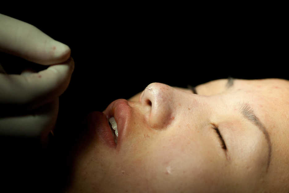 Medical workers finish suturing a patient's nose at Shenzhen Humanity Hospital